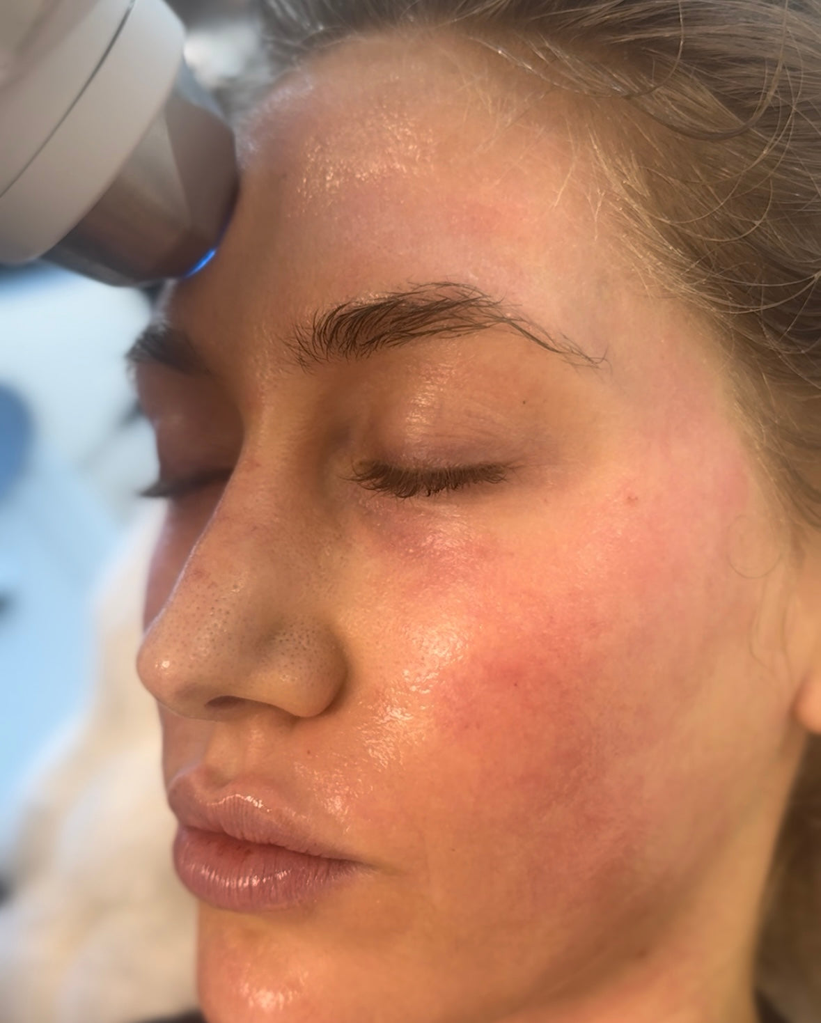 AVAVA Resurfacing Deep Facial