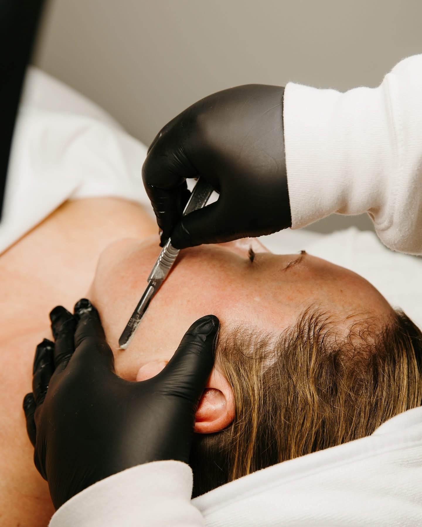 Dermaplane Facial