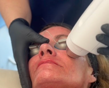 AVAVA Resurfacing Light Facial