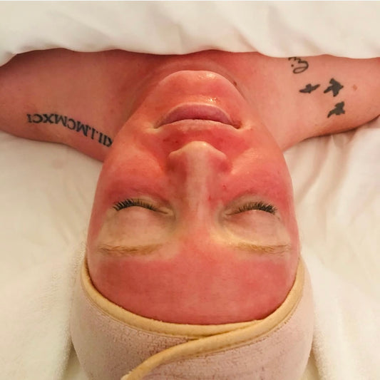 Collagen P.I.N Microneedling